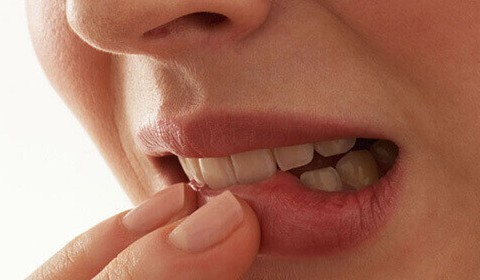 What Are Canker Sores? Are They the Same as Cold Sores?
