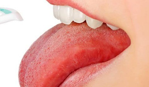 Learn What Your Tongue Color Tells about Your Health