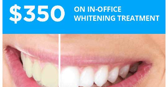 Zoom Whitening Get Your Smile Ready for Spring With Our Great Deal – #ZoomWhitening