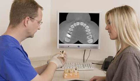 Dental Implants or Dental Bridges? What Is Better for You?
